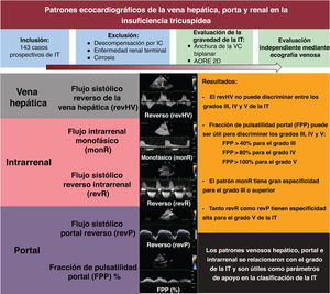 Graphical Abstract Caracterización de los patrones de flujo venoso h...