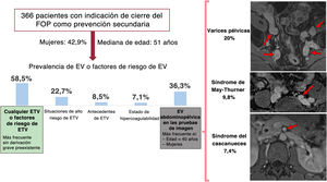 Graphical Abstract Prevalencia de la enfermedad tromboembólica venos...