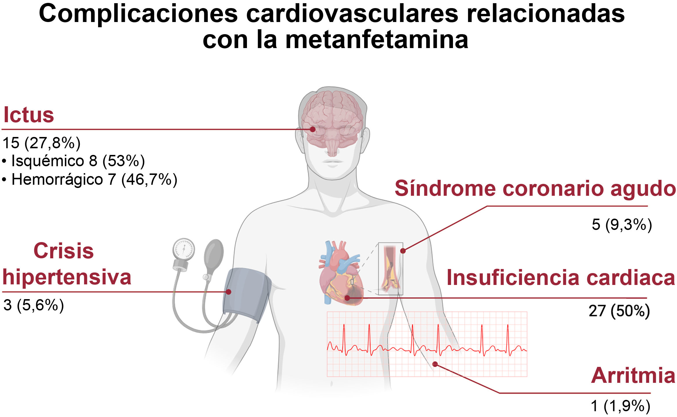Imagen extra