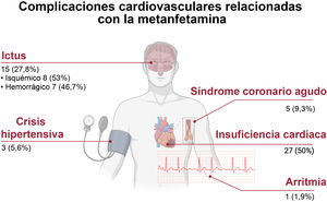 Graphical Abstract Manifestaciones cardiovasculares en 54 fumadores c...