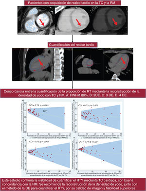 Graphical Abstract Tomografía computarizada frente a cardiorresonanc...