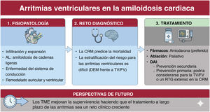 Graphical Abstract Nuevas perspectivas sobre arritmias ventriculares ...