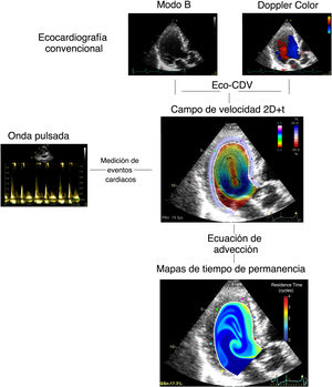 Metodología del mapeo de la estasis. 2D+t: bidimensional con resolución temporal; Eco-CDV: ecocardiografía-velocimetría Doppler a color.