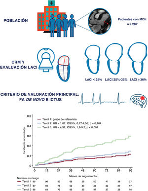 Graphical Abstract Índice de acoplamiento auriculoventricular izquie...