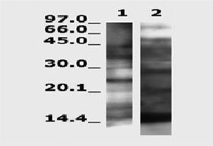 —Immunoblotting test of the pool of sera with extracts of Lepisma (lane 1) and of Dermatophagoides pteronyssinus (lane 2).