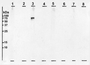 —Immunoblot for whites and yolks from different eggs performed in the patient. Lane 1: White of chicken's egg. Lane 2: Yolk of chicken's egg. Lane 3: White of quail's egg. Lane 4: Yolk of quail's egg. Lane 5: White of duck's egg. Lane 6: Yolk of duck's egg. Lane 7: White of goose's egg. Lane 8: Yolk of goose's egg.