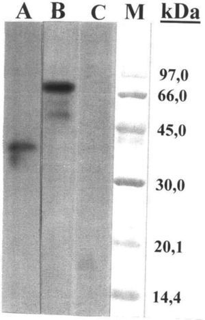 SDSPAGE immunoblotting with scale extract: (A) with urine and stools extract; (B) control serum (pooled from nonatopic individuals); (C)M: molecular mass marker.