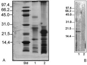 A. SDS-PAGE (silver stain) of the kiwifruit extracts. Std: Standard Low molecular weight BioRad; Lane 1: Gold Kiwifruit extract (100μg); lane 2: kiwifruit extract (100μg). B. Immunoblot Chemiluminiscence of kiwifruit extracts. Lane 1: Gold Kiwifruit extract (100μg); lane 2: kiwifruit extract (100μg). Dilution of the serum 1:2.