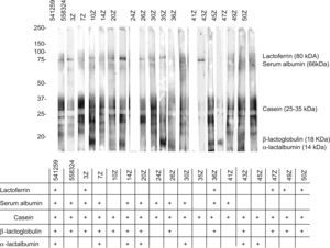 SDS-PAGE-IgE-Immunoblotting of the 18 sera from patients revealing specific IgE values to milk higher than 20kU/l. Solid-phase was prepared by electrophoretic transference of fractionated dairy milk to Immobilon-P membranes.