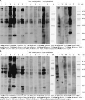 A. SDS:PAGE immunoblotting with latex extracts. Without mercaptoethanol, in almost all the lines we can see bands of approximately 132, 109, 58, 44, 40, 37, 29 and 19KDa. In some lines, there were bands of approximately 22 and 14KDa. B. The same assay with mercaptoethanol: almost all the sera had similar pattern: 42–36 and 34KDa bands, and 18, 17, 16, and 14.5KDa bands.