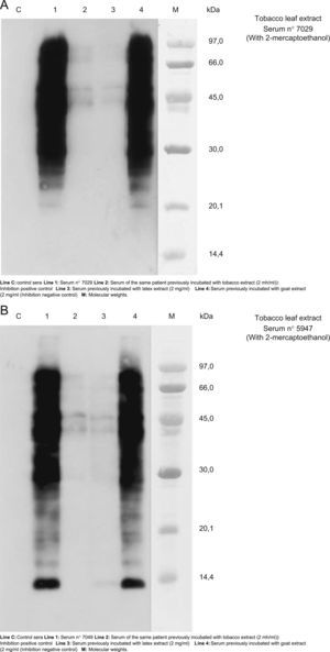 A and B. Results of cross-reactivity using SDS-PAE Immunoblotting inhibition using the sera numbers 7029 and 547 (patients 4 and 6 respectively) as representation of other patients because in the blott-assay with these sera all bands of detection of IgE were showed. These results evidenced a cross-reactivity between tobacco and latex extracts.