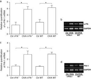 Quantitative real-time RT-PCR detection of u-PA and PAI-1 mRNA in saline- (Control, Ctr) and OVA-treated t-PA-/- and WT mice nasal mucosa. (a) The u-PA mRNA quantitative, (c) the PAI-1 mRNA quantitative. In addition, the electrophoretic patterns of PCR products are shown in b and d. (n=5 each, *p<0.05).