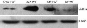 Western blotting detected the MMP-9 protein content in OVA-challenged and saline-treated (Control, Ctr) t-PA-/- WT mice. The OVA-challenged t-PA-/- mice showed weaker expression compared with OVA-challenged WT and saline-treated t-PA-/- mice.