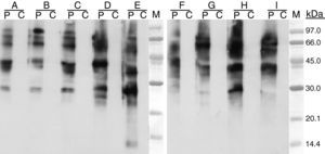 SDS–PAGE immunoblotting. Lane P: patient serum, lane C: control serum, incubated with extracts from: curry I (A), curry II (B), curry III (C), fennel (D), aniseed (E), dill (F), caraway (G), cumin (H), coriander (I). M: molecular weight standards.