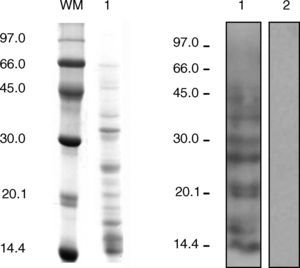 SDS PAGE: Lane 1, lipophilic fraction from olive fruit. IgE-immunoblotting: Lane 1, patient