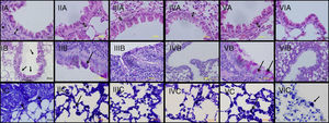 Light microscopic findings of groups I–VI. I: asthma; II: curcumin 10; III: curcumin 20; IV: dexamethasone; V: DMSO, VI: control group. In representative histological images, lung tissues were stained with H&E (A), PAS (B) and toluidine blue (C). In Asthma (IA), DMSO (VA) and Cur10 (IIA) groups, H&E staining revealed thickened epithelium, thickened subepithelial smooth muscle (arrow with two heads) and peribronchiolar mononuclear infiltration (*). High numbers of goblet cells (arrows) were seen with PAS-staining in asthma (IB), DMSO (VB) and Cur10 (IIB) and mast cells with toluidine blue staining in asthma (IC), DMSO (VC) and Cur10 (IIC). In Cur20 group, subepithelial smooth muscle thickness decreased and a reduction in the number of goblet and mast cells were observed compared to the DMSO and cur10 groups. Cur20 suppressed goblet cell hyperplasia in lung tissue.