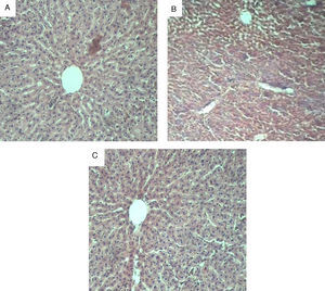 Light photomicrographs of rat liver (haematoxylin and eosin stains, magnification 100×): (A) Control rat liver section (B) d-GalN/LPS-intoxicated rat liver section; (C) liver section of rat pre-treated with garlic.