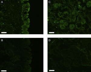Photomicrographs of fluorescence immunohistochemical staining for erbB1. The images show positive staining/negative control pairs of the epithelial layer (A/B) and nasal gland (C/D). Scale bar=50μm.