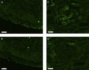 Photomicrographs of fluorescence immunohistochemical staining for erbB3. The images show positive staining/negative control pairs of the epithelial layer (A/B) and nasal gland (C/D). Scale bar=50μm.