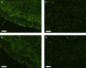 Photomicrographs of fluorescence immunohistochemical staining for erbB4. The images show positive staining/negative control pairs of the epithelial layer (A/B) and nasal gland (C/D). Scale bar=50μm.