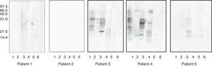 Immunoblotting. Dilution serum 1/2. Solid phase: 50μg of protein of either extrac/lane. Lane 1: Goat casein. Lane 2: Goat whey proteins. Lane 3: Sheep casein. Lane 4: Sheep whey proteins. Lane 5: Cow casein. Lane 6: Cow whey proteins.