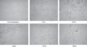Microscopic view of Sf9 cells after transfection with purified bacmid via lipofection. Cells from pre-transfection as well as several hours post-transfection (4, 24, 48, 72, and 96h) were captured. Note the increment of cell diameter and granular appearance of transfected cells and also their lysis at the final steps. The increased amount of cell debris and decreased cell count were obvious in late hours post transfection. There was no significant difference between the appearances of the cells which were infected with wild type or recombinant bacmid.
