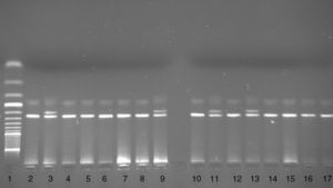 Genotyping of the d32 polymorphism in the CCR5 gene. Line 1 – O’Range Ruler™ 50bp DNA Ladder (FERMENTAS, Latvia). Lines 2, 4, 5, 6, 7, 8, 10, 12, 14, 15, 16 and 17 – wt/wt genotype. Lines 3, 9, 11 and 13 – wt/d genotype.