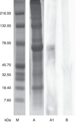 Eruca sativa protein identification. Molecular markers (lane M). SDS-PAGE with extracts of raw E. sativa (lane A) and immunoblotting with serum from the E. sativa sensitive patient (lane A1). Negative control serum (lane B).