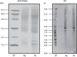 SDS–PAGE and IEF of both mite species extracts. ST: standard; Ag: A. gracilis; As: A. siro.