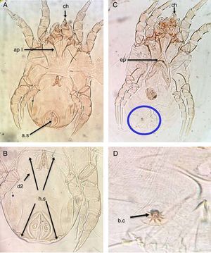 D. pteronyssinus. (A) Ventral view of male. (B) Dorsal view of male. (C) Ventral view of female. (D) Flower-shaped apex of bursa copulatrix. Chelate chelicera (ch), apodem1 (ap1), anal suckers (a.s), oblong hysterosomal shield (h.s, arrows), dorsal seta (d2), crescentic epigynium (ep).
