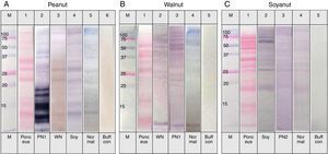 Immunoblot analysis of peanut (A), walnut (B) and soybean (C) protein extracts with pooled sera each containing peanut, walnut and soybean specific IgE. M: Molecular weight marker, PN 1: pooled sera with peanut specific IgE without walnut sensitisation (Table 1. Group1), WN: pooled sera with walnut specific IgE without peanut sensitisation (Table 1. Group 2), PN 2: pooled sera with peanut specific IgE without soybean sensitisation (Table 1. Group 3), Soy: pooled sera with soybean specific IgE without peanut sensitisation (Table 1. Group 4), Normal: pooled sera without allergic sensitisation, Buff Con: buffer control.