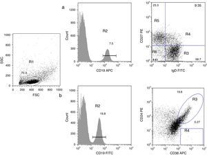Analysis of B cell subpopulations by flow cytometry. (a) CD19+ B cells (R2) were gated within the lymphocyte side- and forward-scatter region (R1). Using panel 1, the cells can be subdivided into several subpopulations: naïve B cells (R3, CD19+CD27−IgD+), non-switched memory/marginal-zone-like (R4, CD19+IgD+CD27+), class-switched memory B cells (R5, CD19+CD27+IgD−), double-negative B cells (R6, CD19+CD27−IgD−). (b) By using panel 2, it is possible to distinguish transitional B-cells (CD19+CD38++CD24++) and plasmablasts (CD19+CD38+++CD24−).