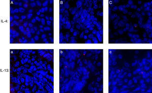 The expression of IL-4 and IL-13 in nasal mucosa by immunocytochemistry. Picture A or a were control group, B or b were AR-sensitised, C or c were HRS group. Red fluorescence were Fluorescent labelling of IL-4 or IL-13.