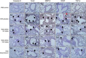 Immunohistochemical staining results of study groups. PBS Control (n:5), OVA-placebo (n:5), OVA-50mg/kg UDCA (n:6), OVA-150mg/kg UDCA (n:6), OVA-dexamethasone (n:5). (A) Caspase-3, (B) TUNEL, (C) MMP-9, (D) VEGF, (E) TGF-β. Black arrows show positive staining with caspase 3, TUNEL, MMP-9, VEGF and TGF-β, respectively. Red arrow shows positive staining with VEGF more detailed. VEGF, vascular endothelial growth factor; MMP-9, matrix metallo proteinase-9, TGB-β, transforming growth factor-β, TUNEL, terminal deoxynucleotidyl transferase-mediated dUTP nick endlabeling and caspase-3, cysteine-dependent aspartate-specific proteases.