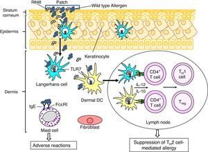 A putative therapeutic mechanism in EPIT to treat allergy. Allergens, which are applied on the surface of skin using a patch, are captured by Langerhans cells (LCs) in the epidermis and dermal dendritic cells (dDCs). These antigen presenting cells move to lymph nodes to prime CD4+ T cells. LCs, DCs, keratinocytes and fibroblasts in cutaneous tissues produce pro-inflammatory and anti-inflammatory cytokines, depending on stimuli. Use of an adjuvant, e.g. a Toll-like receptor 7 ligand R848, inducing TH1 cytokines (e.g. IL-12) and/or regulatory cytokines (e.g. IL-10) in LCs and DCs would promote induction of allergen-specific TH1 cells and/or regulatory T cells (Treg), which lead to suppression of TH2 cell-mediated allergy. It should be noticed that mast cells also present in dermis. EPIT using wild type allergens has a risk of adverse reaction due to interaction of the allergens with IgE antibodies captured by Fc¿RI on the cell surface of mast cells. To reduce the risk of adverse reaction, use of hypoallergenic derivatives has been considered.