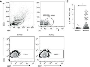 PBMCs were collected from children with asthma (n=136) and healthy controls (n=40), and stained with anti-CD3 and anti-iNKT Vα24Jα18 to assess the presence of invariant natural killer T (iNKT) cells by flow cytometry. (A) Representative flow cytometric analysis of iNKT cells performed in children with asthma and healthy controls. (B) Frequency of CD3+iNKT+ cells. Normality of the samples was tested using Kolmogorov–Smirnov, and Mann–Whitney (U) test was used for comparison of two groups.