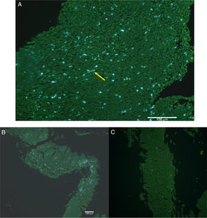 (A) Damaged epithelial cells and intercellular spaces. Arrow shows elongated pollen tube. (B) Callose detection (light points) clearly less evident in biopsies from control groups (C) obtained in the same months (May–June), which showed no damage to spinous epithelial cells.