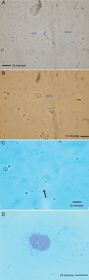 (A–C) Flagellated protozoa in intestinal extracts from HDM (scale bar=15μm, fresh sample×1000). (D) flagellated protozoon in the intestinal extract from HDM (scale bar=15μm, Wheatley's trichrome×1200).