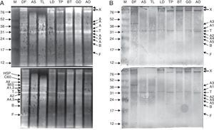 Purified proteins separated by 15% Tris-glycine electrophoresis, blotted onto nitrocellulose membranes and stained with SYPRO ruby protein blot stain (A). The antigens were further probed using sera from 20 patients allergic to house dust mites, followed by anti-human IgE antibody reactivity assessment. IgE-reactive proteins were visualised using the TMB substrate (B). Legend: A – actin; T – tropomyosin monomer; B – Der f 7 allergen (identified only in the DF sample); F – ferritin Der f 30 (identified only in the DF sample); Alt – Der f Alt a 10 allergen homolog (gi|37958173) (identified only in the DF sample); Apo – apolipophorin, group 14 mite allergen (identified and corresponding bands present only in the DF sample); C60 – 60kDa chitinase-like allergen (identified only in the DF sample); C90 – 90kDa chitinase-like allergen (identified only in the DF sample); MIS – miscellaneous IgE-reactive protein of Dermatophagoides farinae; X – accumulated proteins of higher molecular weight; AO – Aleuroglyphus ovatus; GD – Glycyphagus domesticus; BT – Blomia tropicalis; TP – Tyrophagus putrescentiae; LD – Lepidoglyphus destructor; TL – Tyroborus lini; AS – Acarus siro; DF – Dermatophagoides farinae; M – marker.