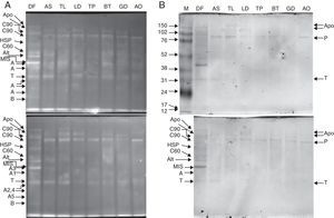 Purified proteins separated by 10% Tris-glycine electrophoresis, blotted onto nitrocellulose membranes and stained with SYPRO ruby protein blot stain (A). The antigens were further probed using sera from 20 patients allergic to house dust mites, followed by anti-human IgE antibody reactivity assessment. IgE-reactive proteins were visualised using the TMB substrate (B). Legend: A – actin; T – tropomyosin monomer; B – Der f 7 allergen (identified only in the DF sample); F – ferritin Der f 30 (identified only in the DF sample); Alt – Der f Alt a 10 allergen homolog (gi|37958173) (identified in the DF sample); Apo – apolipophorin, group 14 mite allergen (identified in the DF sample); C60 – 60kDa chitinase-like allergen (identified in the DF sample); C90 – 90kDa chitinase-like allergen (identified in the DF sample); HSP – heat shock protein (identified in the DF sample); MIS – miscellaneous IgE-reactive protein of Dermatophagoides farinae; AO – Aleuroglyphus ovatus; GD – Glycyphagus domesticus; BT – Blomia tropicalis; TP – Tyrophagus putrescentiae; LD – Lepidoglyphus destructor; TL – Tyroborus lini; AS – Acarus siro; DF – Dermatophagoides farinae; M – marker.