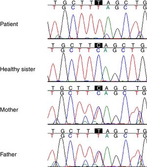 Chromatogram relate to Sanger validation and segregation of the mutation (chr1: 22965784 C>T) in patient, parents and healthy sibling.