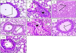 Sections from mice lung (H&E stain) (×400) showing bronchioles of normal control (NC), positive control (PC), and inhaled albuterol (A), furosemide (F), bumetanide (B), albuterol+furosemide (A+F), and albuterol+bumetanide (A+B). Normal control (NC) shows patent bronchioles (Br) with normal lining epithelium (dotted arrows) and muscle layer (white arrow). Nearby alveoli (AL) have thin wall and patent lumina. Positive control (PC) shows collapsed bronchioles (Br) full of mucous secretion and mononuclear inflammatory cells (black star). The wall is slightly thickened (white arrow). Nearby alveoli (AL) are collapsed and full of inflammatory cells. Albuterol (A) shows normal patent bronchioles (Br) and slight thickened alveolar wall. Furosemide (F) shows patent bronchioles (Br) with residual thick epithelium and inflammatory cells (dotted arrows). Bumetanide (B) shows marked obstruction of bronchioles (Br) with mucous and inflammatory cells (star). The lining epithelium (dotted arrows) and bronchial wall (white arrow) showed hypertrophy and the alveolar wall is thick (AL). Albuterol+furosemide (A+F) shows patent bronchioles (Br) with normal epithelium (dotted arrows). The alveoli (AL) showed normal epithelial lining and free of cell infiltrate. Albuterol+bumetanide (A+B) shows patent bronchioles (Br) with thick epithelium. The alveoli (AL) are patent with slight thickened wall.