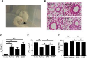 OPG eased asthma inflammatory reaction. (A) Mice were immunized with OVA to induce the asthma model. Typical behavior was observed. (B) Lungs were fixed in 10% buffered formalin, and lung sections were examined by H&E staining. (C) IgE level in blood serum was detected with ELISA and compared. (D) IFN-γ level in BALF was detected with ELISA and compared. E. IL-8 level in BALF was detected with ELISA and compared. (*p<0.05, **p<0.01, ***p<0.001, DXM: dexamethasone).