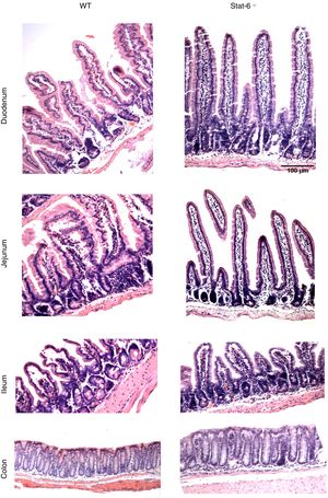 Histopathological analysis reveals intestinal damage in wild-type (WT) but not in Stat-6−/− mice sensitized and challenged with peanut seeds. Animals were sensitized with peanut proteins extract (PPE) and challenged with a chronic exposure to peanut seeds for four weeks (S+Peanut group), when the gut samples were collected for paraffin processing and histology evaluation. Note the inflammatory infiltrate, tissue destruction, epithelial exulceration, edema, congestion and loss of villous architecture in the duodenum, jejunum and ileum samples of WT mice (*). These alterations were almost absent in Stat-6−/− mice and in the control groups of both lineages (NS, S and Peanut groups, data not shown). The colon samples did not depict any sign of inflammatory destruction too. Results are representative of three independent experiments. Scale bar=100μm.