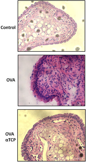 Representative sections of the nasal tissue seen at a magnification of ×400 after hematoxylin and eosin staining. n=10 each group. Data are representative of at least two independent experiments.