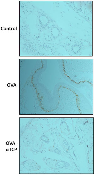 Altered immunohistochemical expression of mast cell tryptase after OVA and α-TCP treatment. n=5 each group. Data are representative of at least two independent experiments.
