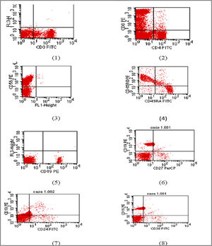 Flow cytometry charts of Patient 5. (1) CD3 within normal range (2) reduced CD4 with inverted CD4/CD8 ratio. (3) Natural killer cell within normal. (4) Reduced naïve T cell. (5) Markedly reduced B lymphocytes (6) memory B cells are within normal percentage. (7) and (8) Relatively increased transitional B cells.