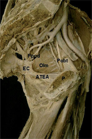 Hemipelvis izquierda en visión medial. EC: espina ciática; OIm: múculo obturador interno; P: sínfisis púbica; Pobt: paquete vasculonervioso obturador.