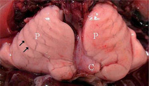 Vista macroscópica de los pulmones (P), con la impronta (flechas negras) por compresión de las costillas del feto. El corazón (C) parece tener un tamaño menor, sin embargo, es normal.