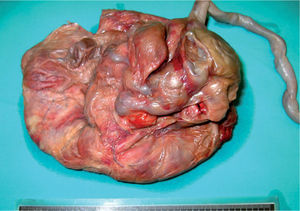 Placenta.